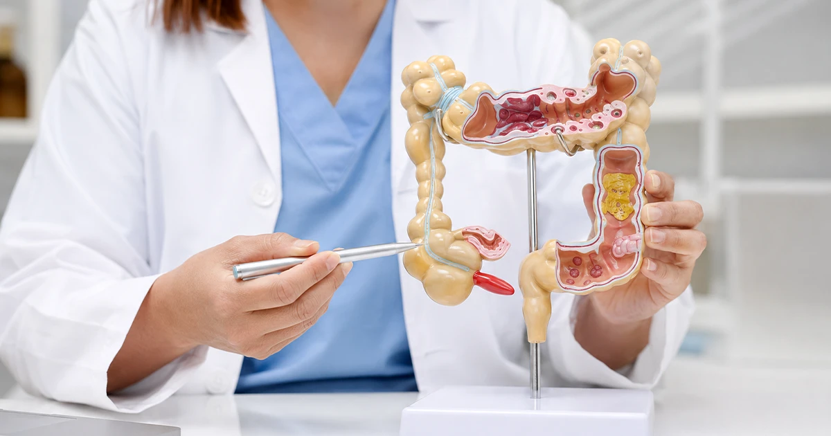 Profissional de saúde apontando para um modelo anatômico do intestino grosso, ilustrando a colonoscopia